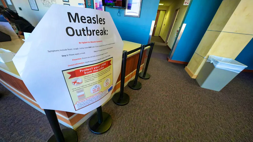 Second child dies after measles outbreak in the USA - Gallery. Measles is one of the most contagious infectious diseases and can be life-threatening in extreme cases. (archive picture)