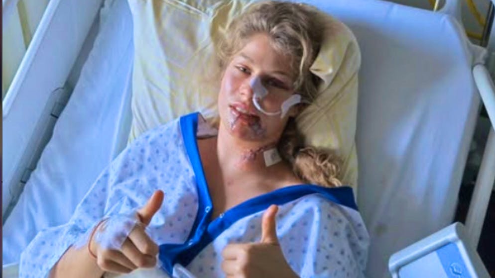 Triathletin überlebt Horror-Unfall. «Zum Glück sind die Splitter nicht bis zur Halsschlagader gelangt»