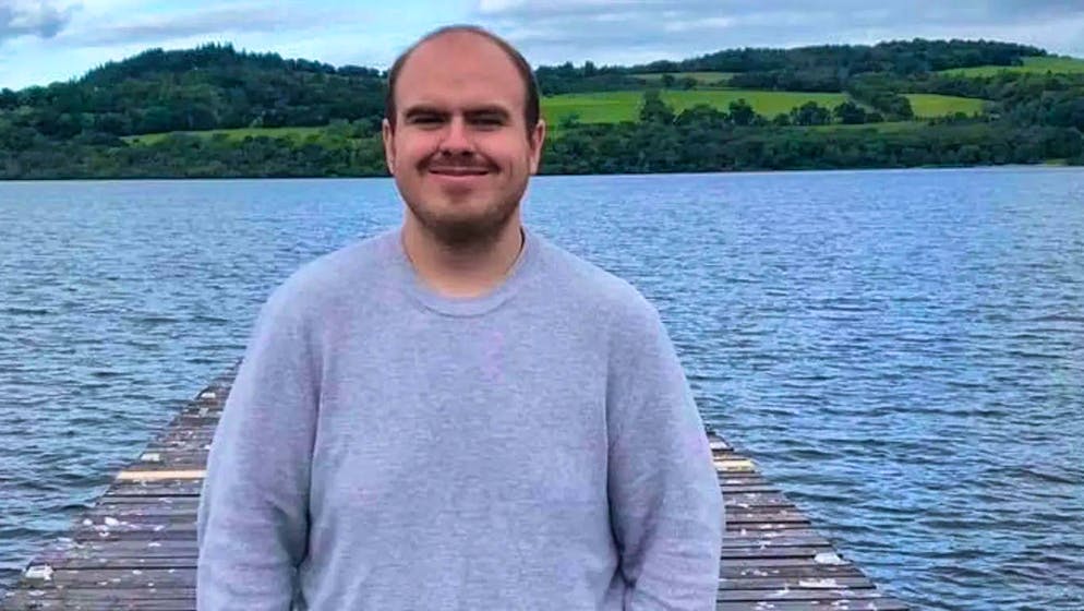 A Lego brick had become lodged in student Darren McConachie's ear - and only came out after 20 years.