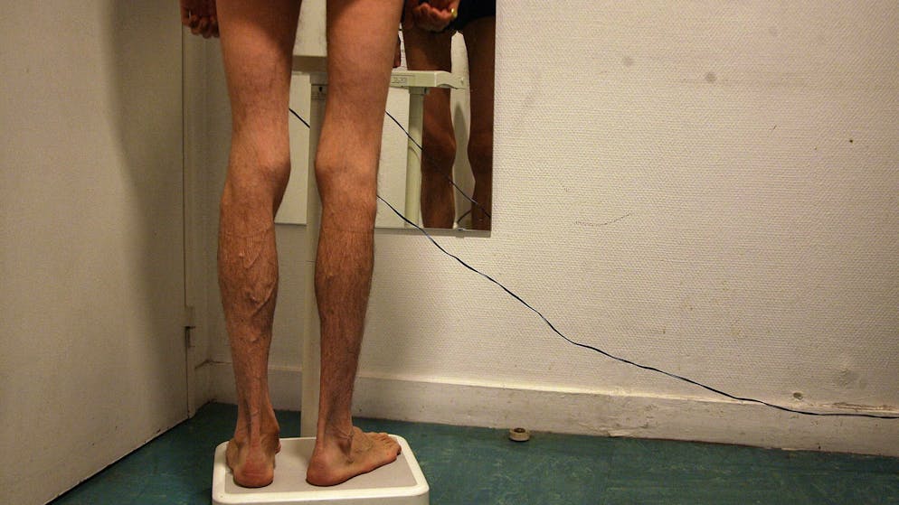 Anorexie, boulimie.... Quelles pathologies derrière les troubles alimentaires ?