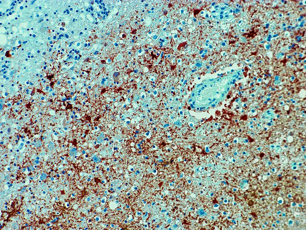 L'immagine non datata mostra il rilevamento di un anticorpo del virus Borna in un tessuto.