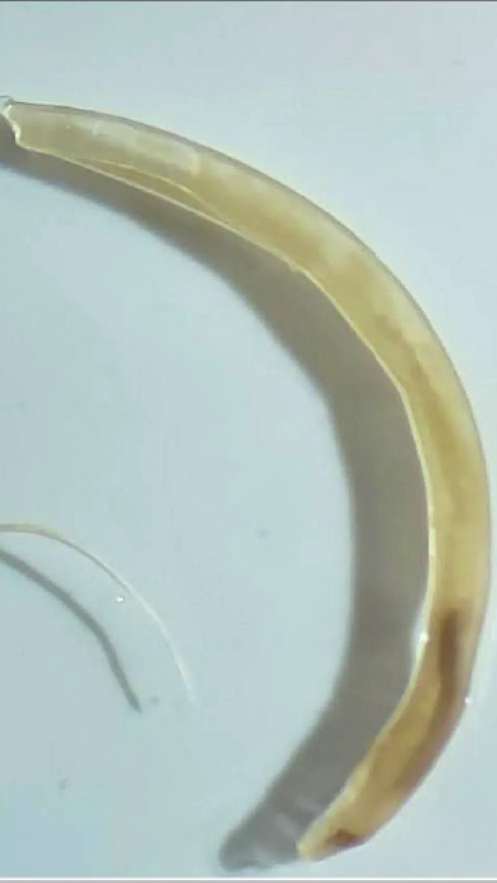 La nouvelle espèce de ver parasite, appelée Trichuris incognita, fait désormais officiellement partie de la collection du Musée d'histoire naturelle de Bâle.