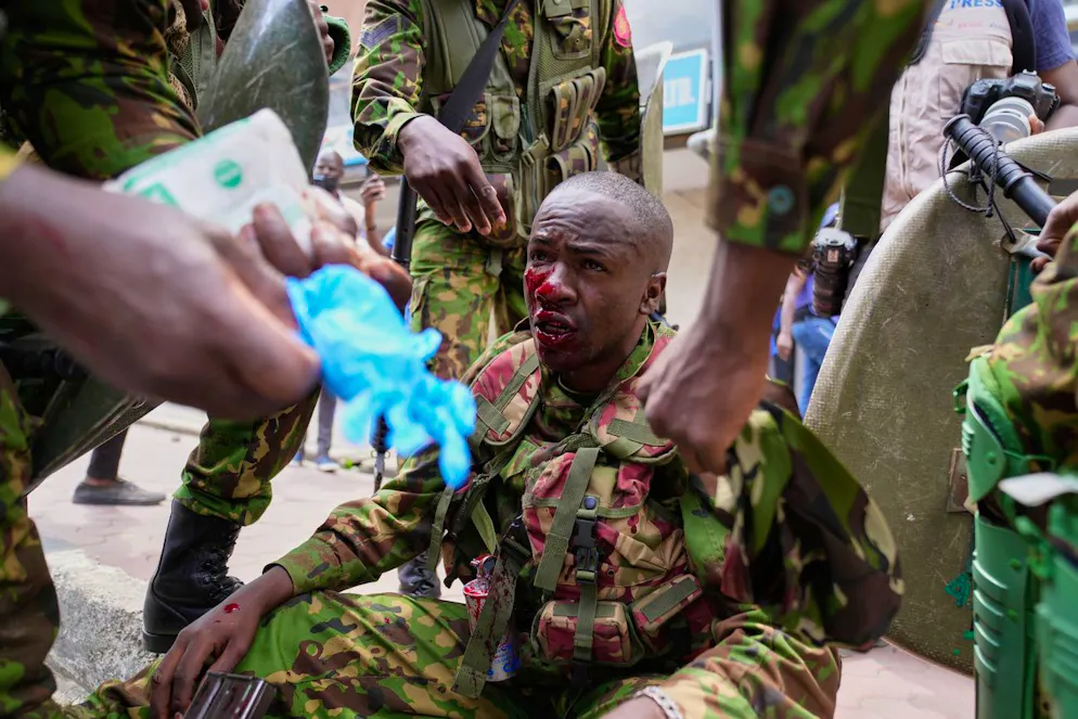 Un policier blessé lors des manifestations organisées à l'occasion du premier anniversaire des violentes protestations contre les taxes est soigné à Nairobi, au Kenya, mercredi 25 juin 2025.