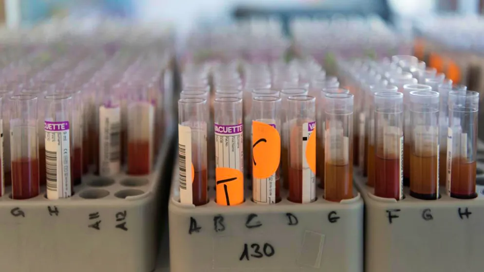 Le médecin, jugé pour homicide par négligence, estime que la prise de sang n'avait rien révélé d'alarmant (photo symbolique).