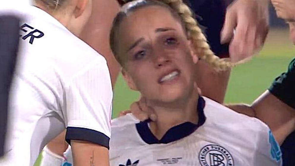 Verletzungsdrama in St.Gallen. Deutschland-Star Giulia Gwinn verlässt den Platz mit Tränen in den Augen