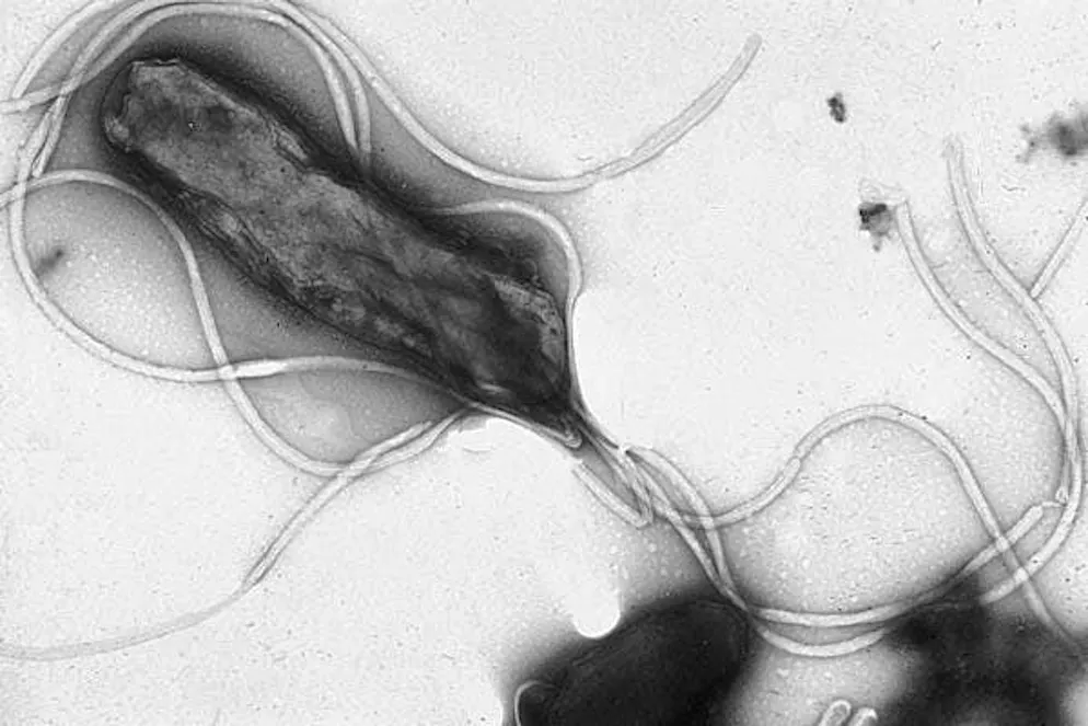 La bactérie Helicobacter pylori peut provoquer un cancer de l'estomac.