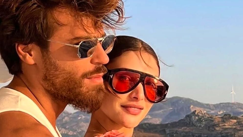 «In silenzio troppo tempo». Sara Bluma, compagna di Can Yaman, mostra i lividi e denuncia le violenze subite dall'ex