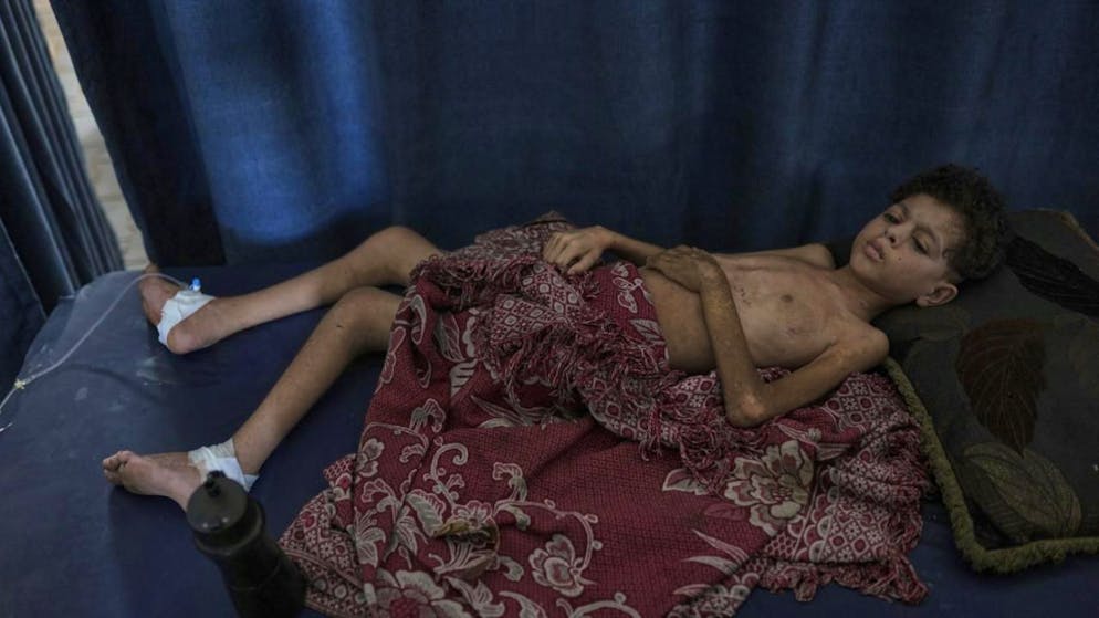 Medio Oriente. Almeno 11 morti per malnutrizione a Gaza in 24 ore