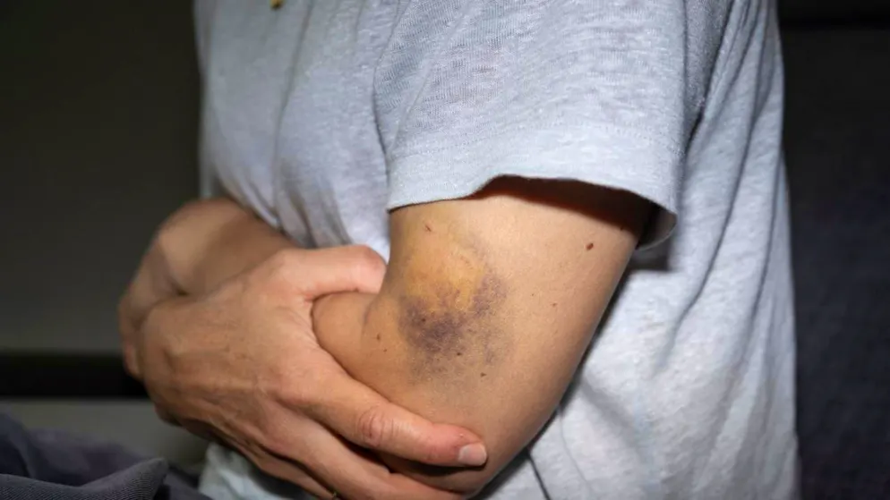 142 attivo 24/24 h. Presentato in Ticino il nuovo numero per le vittime di violenza