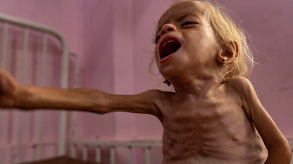 Proche-Orient. Gaza: près d'un enfant sur six gravement malnutri, estime une étude