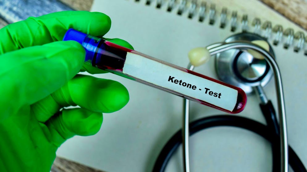 L'Union cycliste internationale ne recommande pas l'usage de compléments alimentaires à base de cétones.