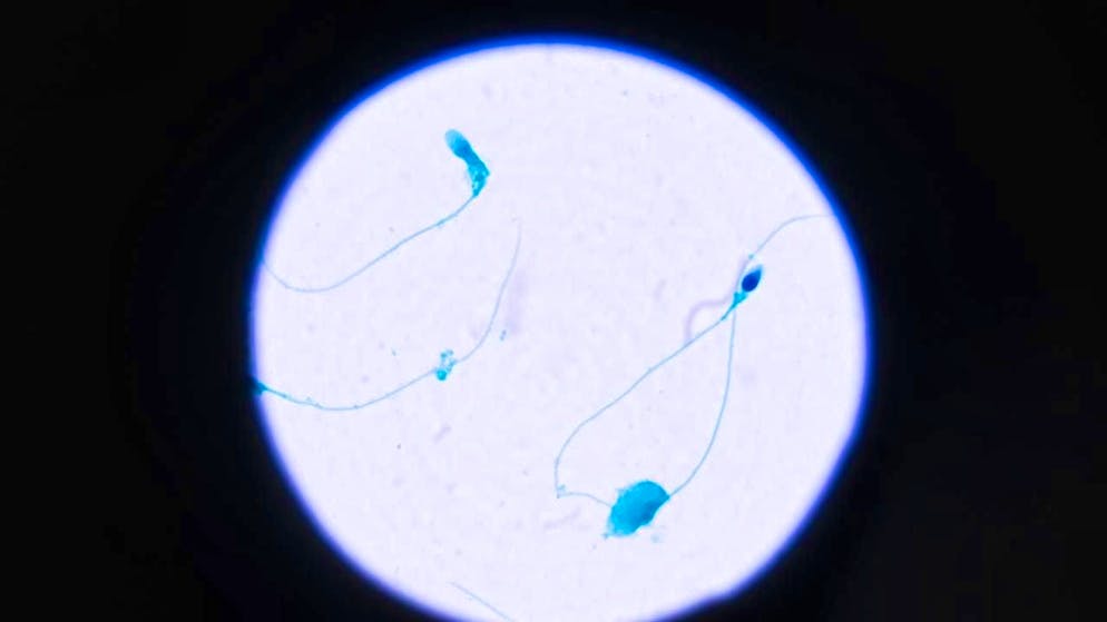 During fertilization, sperm and egg cells cling to each other with a special bond. (archive picture)