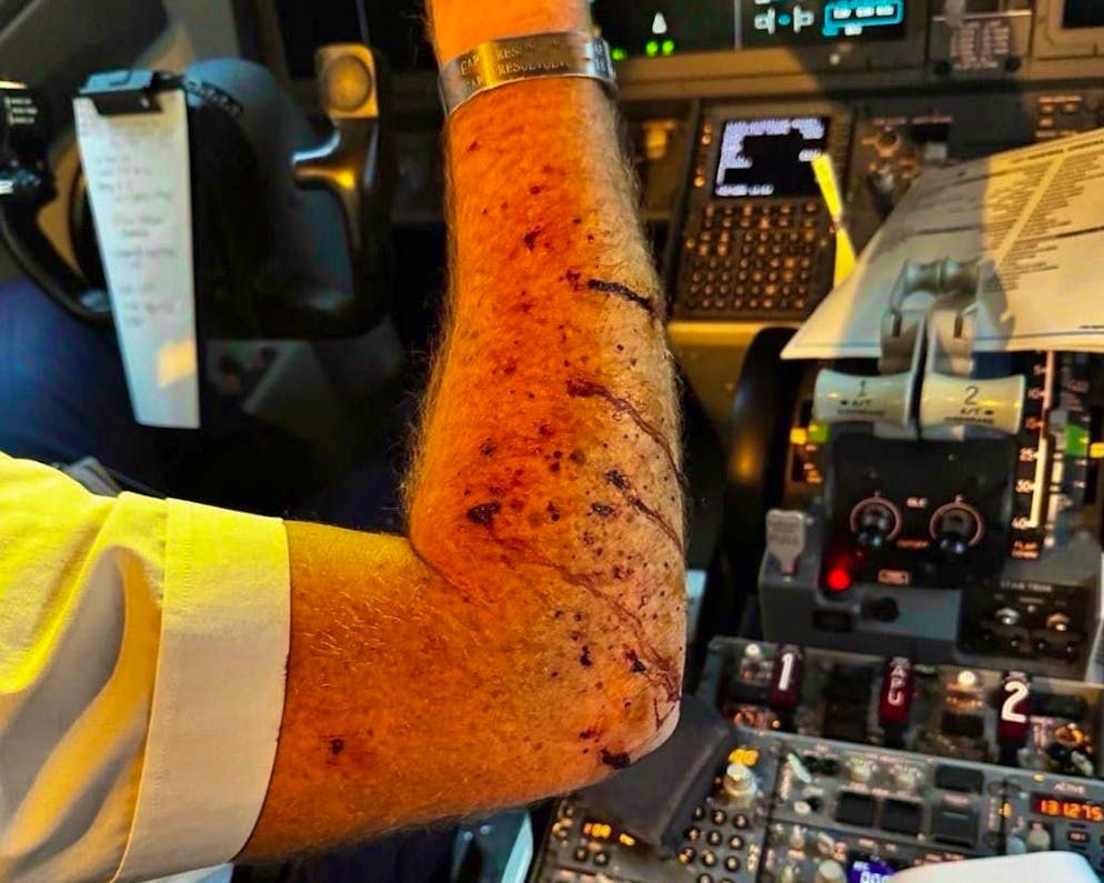 The pilot was injured by the glass splinters. 