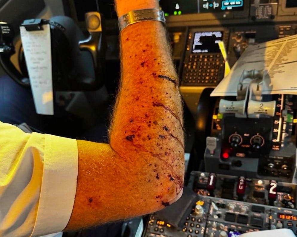 Der Pilot wurde durch die Glassplitter verletzt. 