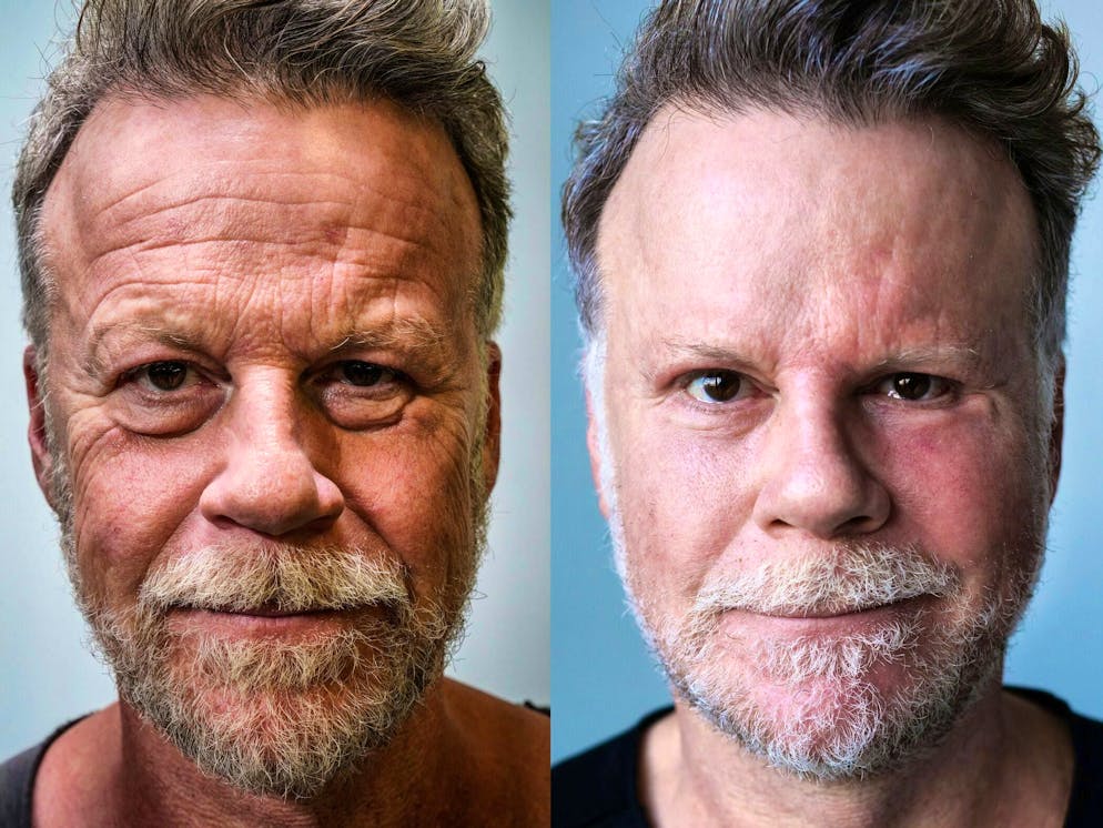 With his "beauty experiment", German journalist Jenke von Wilmsdorff made headlines like no other self-experiment.