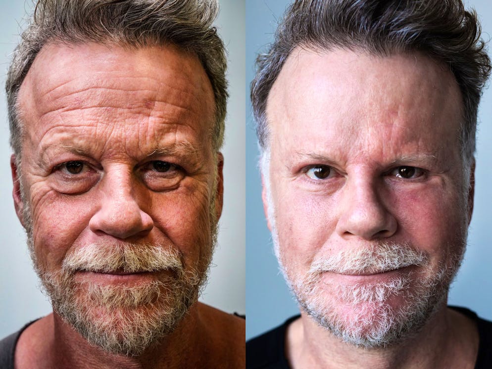 Mit seinem «Schönheits-Experiment» machte der deutsche Journalist Jenke von Wilmsdorff Schlagzeilen wie mit keinem anderen Selbstversuch.