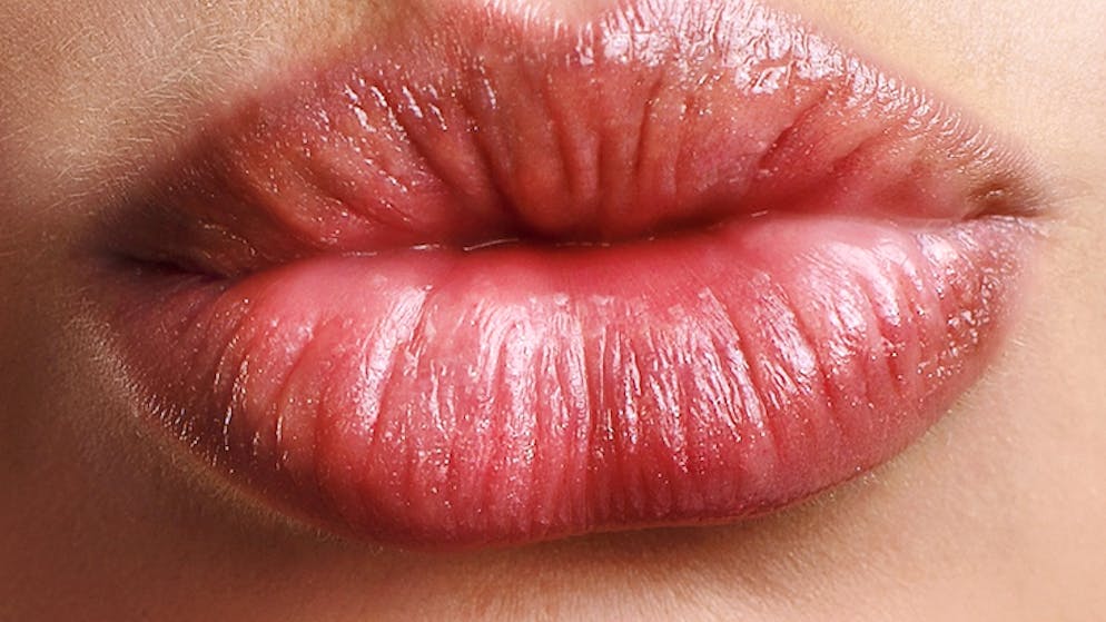 Attention arnaque. Elles voulaient des grosses lèvres, elles ont eu de gros... problèmes!