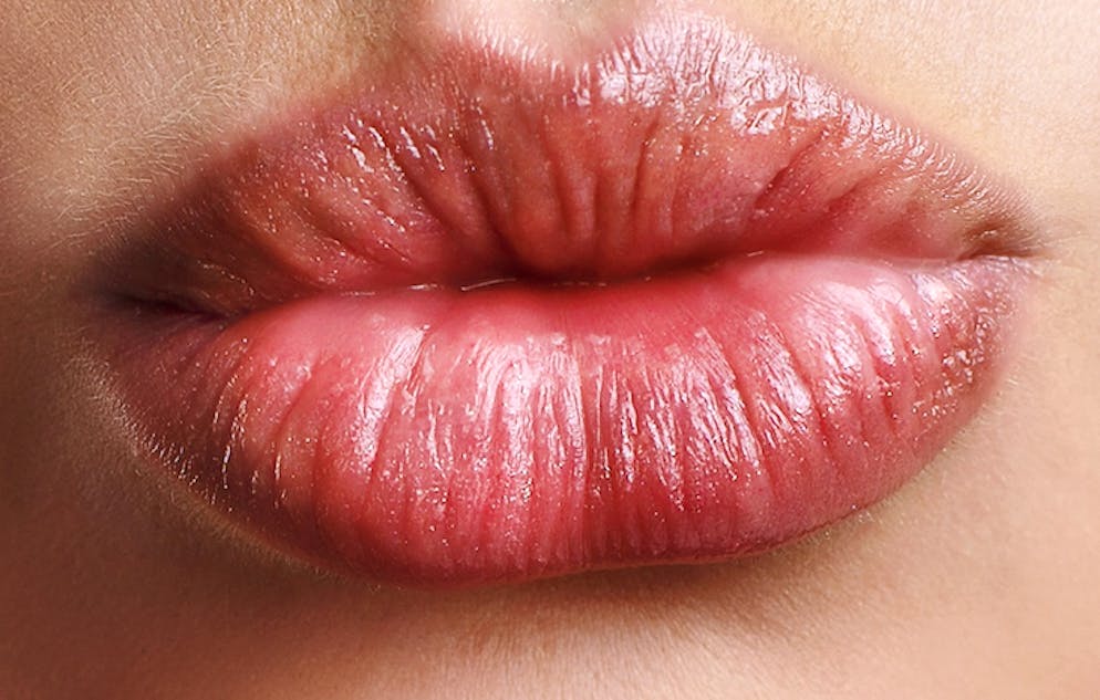 Avoir des lèvres pulpeuses est un rêve pour de nombreuses jeunes filles et c'est même devenu une mode. (image d'illustration)