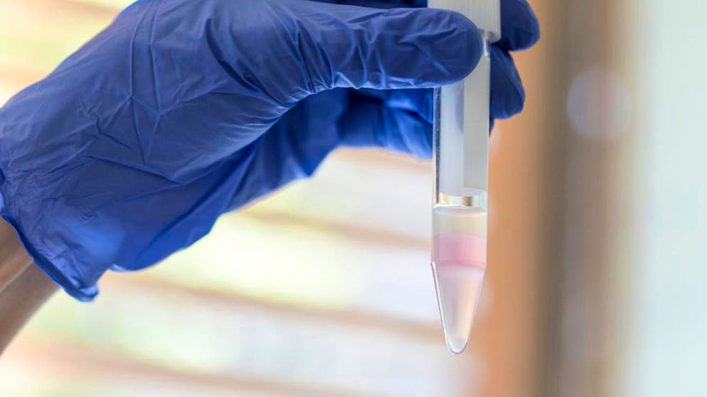 La ricerca ha permesso di individuare regioni con una qualità dello sperma relativamente buona, dette hotspot, e regioni con una qualità dello sperma più scadente, denominate coldspot.(Immagine d'archivio)