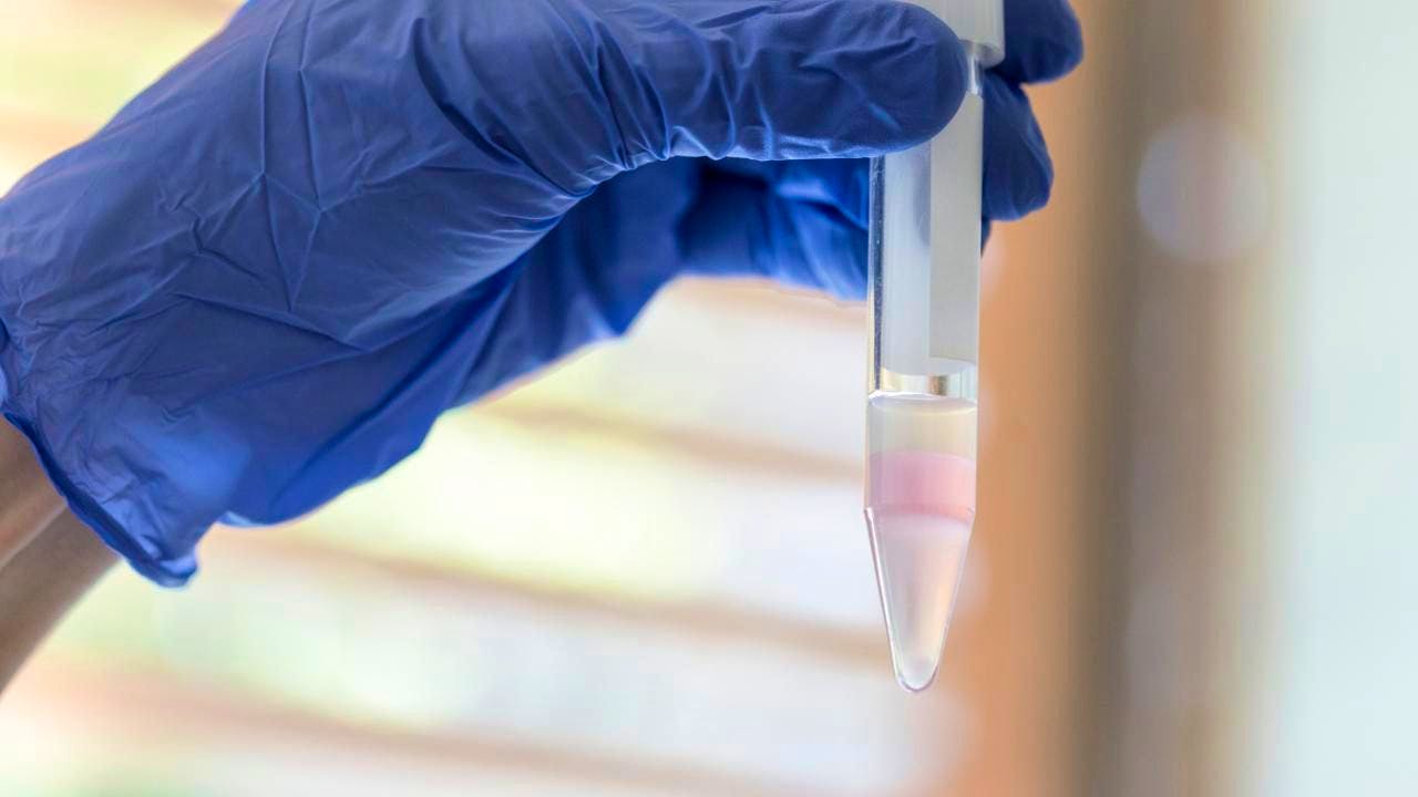 Reproduction. Swiss men in rural regions have poorer sperm quality