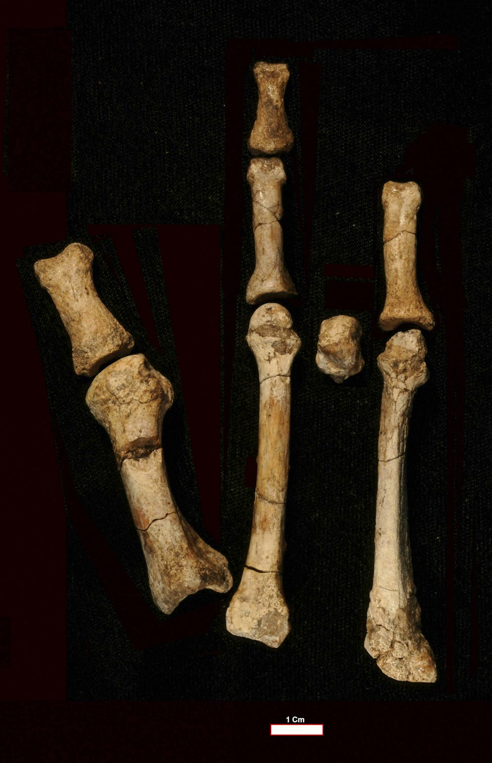 The Burtele foot, an enigma since its discovery in the Afar region of Ethiopia in 2009, with its elements in anatomical position.