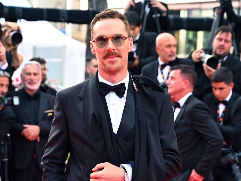 Benedict Cumberbatch ha convissuto a lungo con il dolore. 