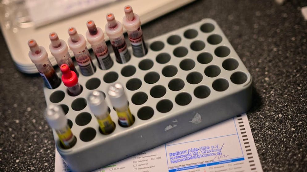 A oggi oltre 40 milioni di persone nel mondo convivono con l'infezione. (Foto simbolica)