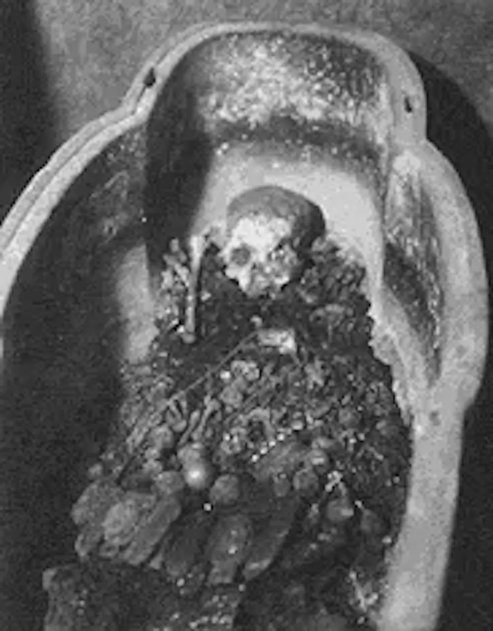 Psusennes_Tanis. Die Reste der Mumie von Psusennes I. Die feuchte Grabluft hat der Mumie und den Bandagen stark zersetzt – geborgen werden konnte am Ende vor allem das Skelett zusammen mit der Goldmaske, den Goldaufsätzen und dem Schmuck.