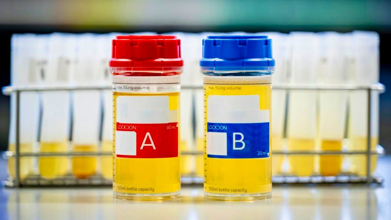 Allgemeines. In Epalinges taucht man ins Herz der Dopinganalyse ein