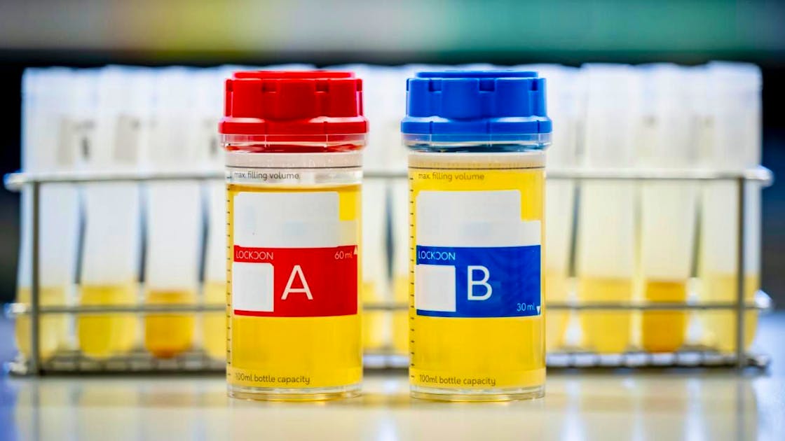 In Epalinges you dive into the heart of doping analysis