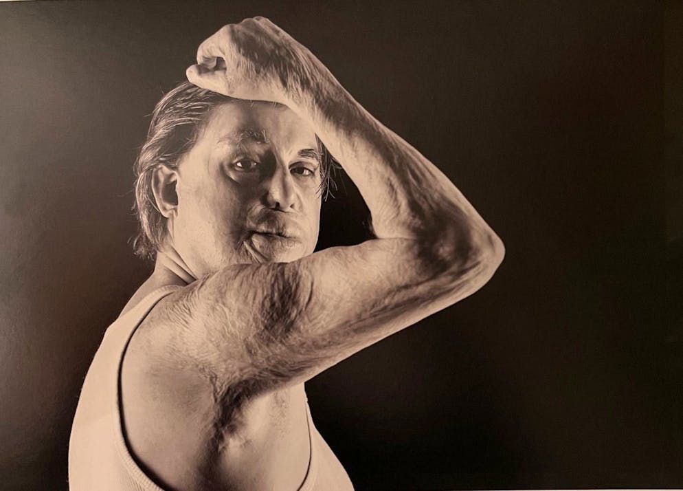 «Ich will mich sehen.» Der Gang zum Spiegel war im Spital für Martin Achermann ein wichtiger Schritt.