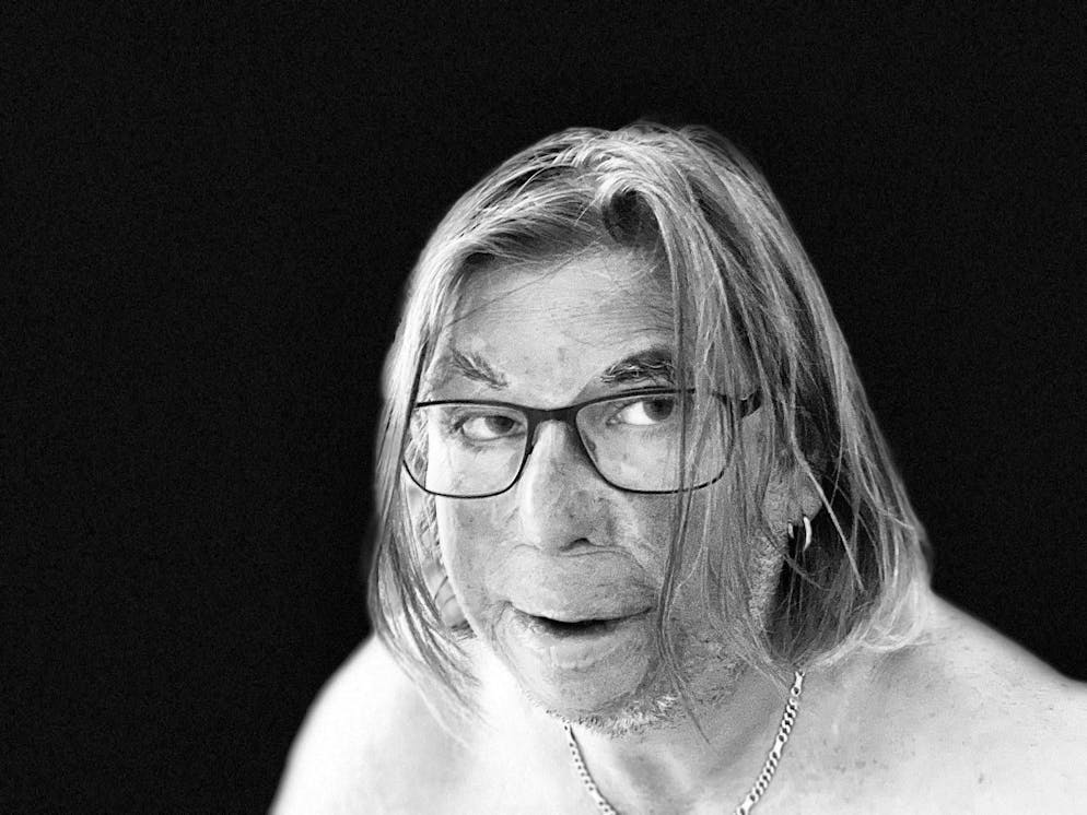 Le cicatrici fanno parte della vita di Martin Achermann, ma non la definiscono.