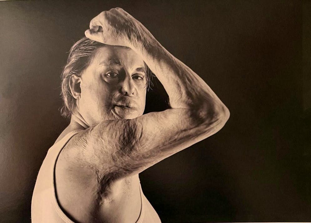 "I want to see myself." Going to the mirror was an important step for Martin Achermann in hospital.