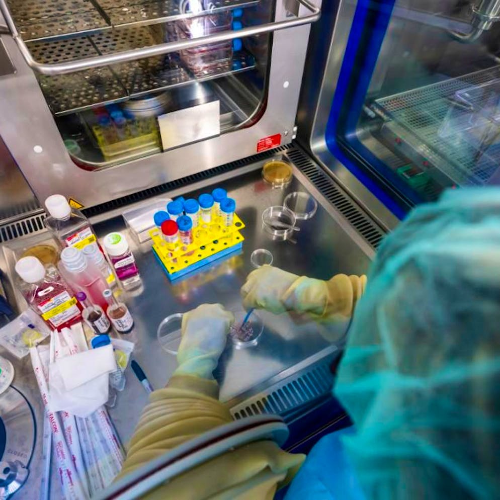 Traitement des grands brûlés. Le centre de production cellulaire d'Epalinges fortement sollicité