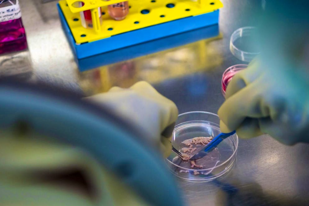 Lausanne laboratory grows skin for Crans-Montana fire victims