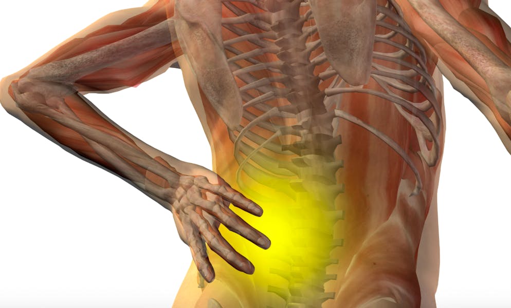 Le Ministère public accuse le chirurgien d'avoir implanté un disque intervertébral artificiel qui n'était pas au point à plusieurs patients.