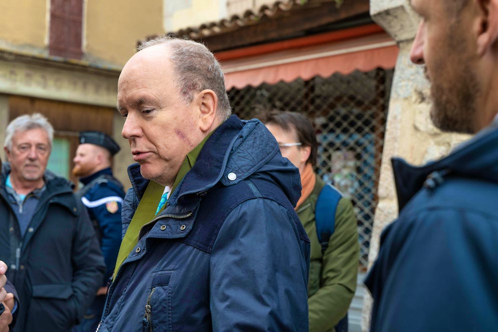 Albert de Monaco à Rome: on distingue une cicatrice sur sa joue.