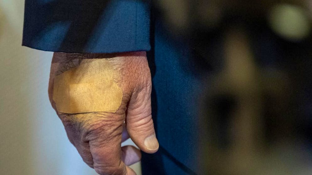 Al WEF di Davos. Mini giallo: da dove viene il livido sulla mano di Trump?