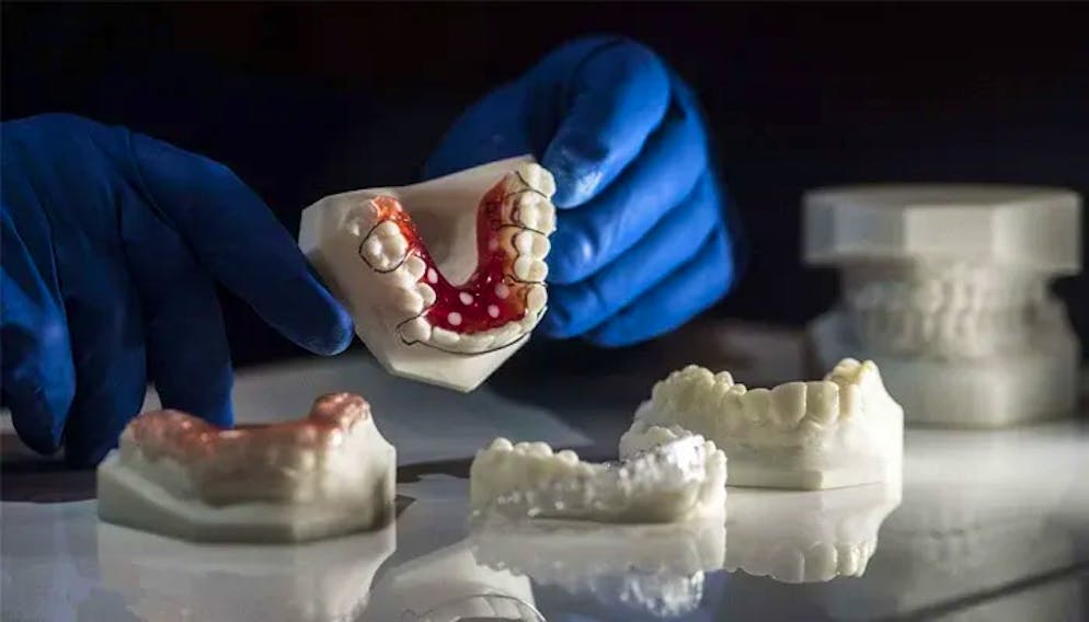 3D-Modelle von Zahnersatzprodukten sind heute schon Standart.