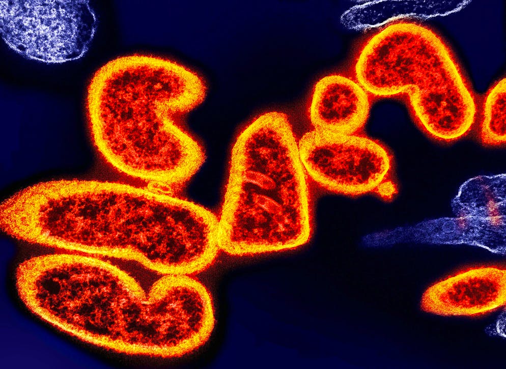 Micrografia elettronica a trasmissione a colori di particelle extracellulari rosse mature del virus Nipah vicino alla periferia di una cellula VERO infettata di colore viola.