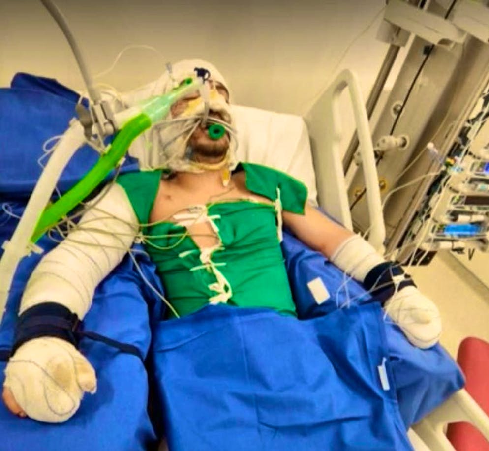 Gaëtan è rimasto in coma per giorni dopo l'incendio a Crans-Montana.