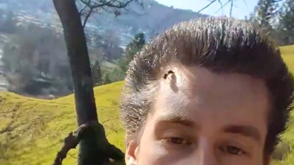 Mediziner warnen vor Trend. Influencer lässt sich von einer Biene stechen – für volles Haar