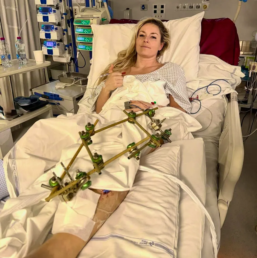 Pollici in su: la stella statunitense Lindsey Vonn aggiorna sull'infortunio.