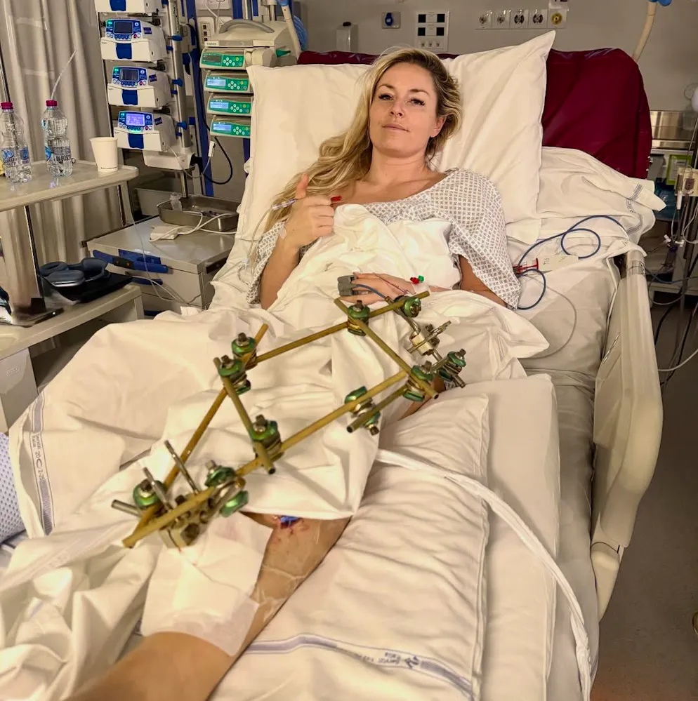 Daumen hoch: US-Star Lindsey Vonn gibt ein Verletzungs-Update.