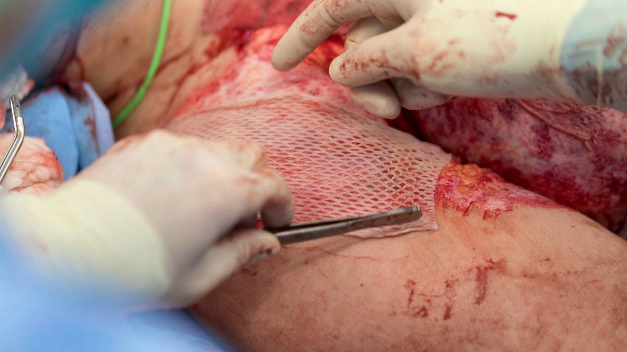 Medicine. Gender difference in burn injuries surprises researchers