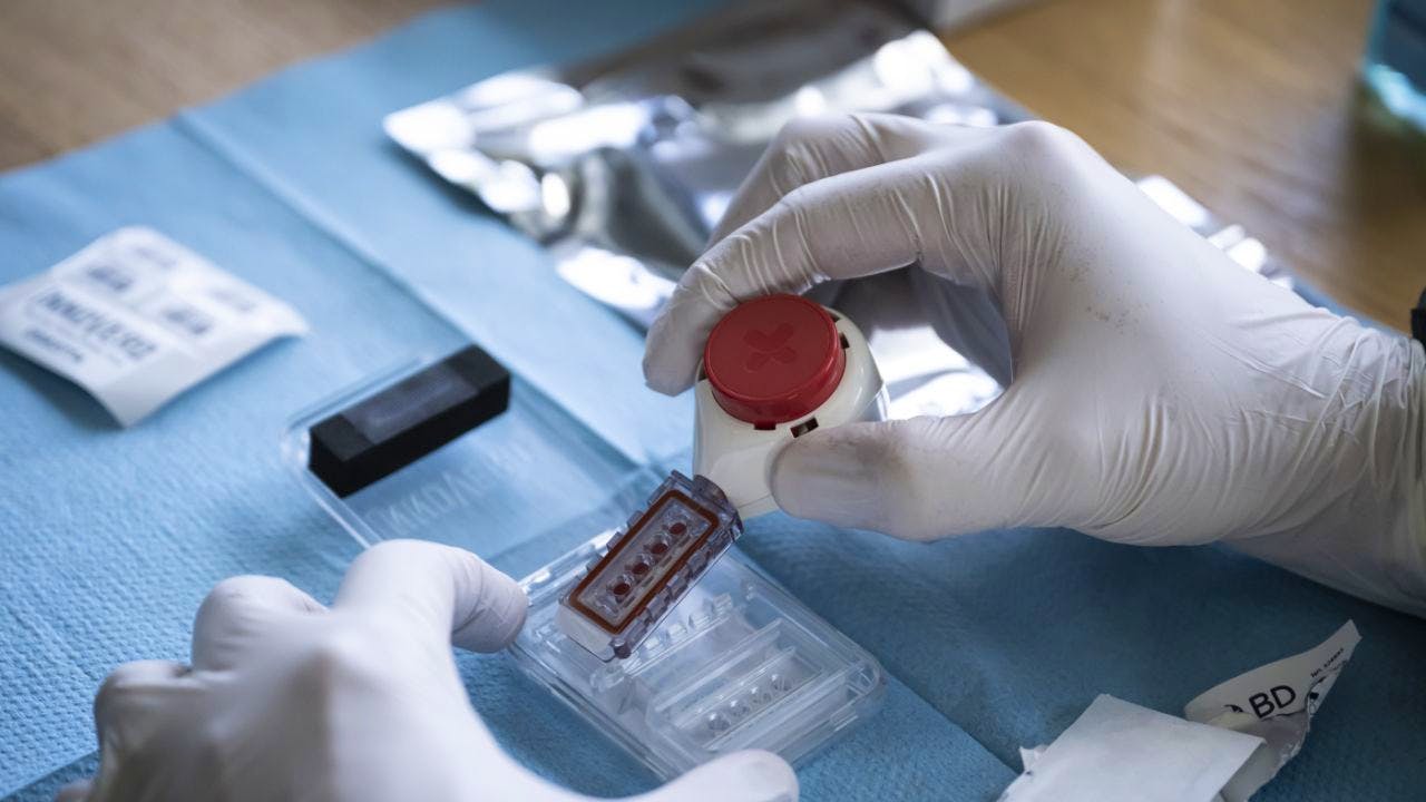 Public service. Confiscated doping: link to Swiss sport being investigated