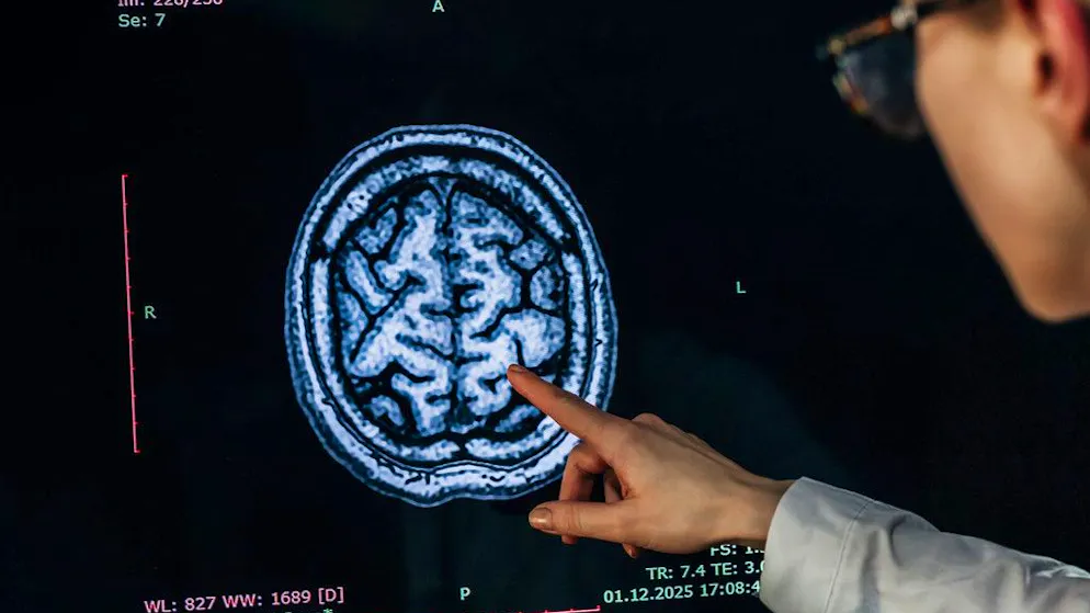 L'IA legge la risonanza del cervello. Un modello auto-apprendente individua segnali precoci di demenza e tumori