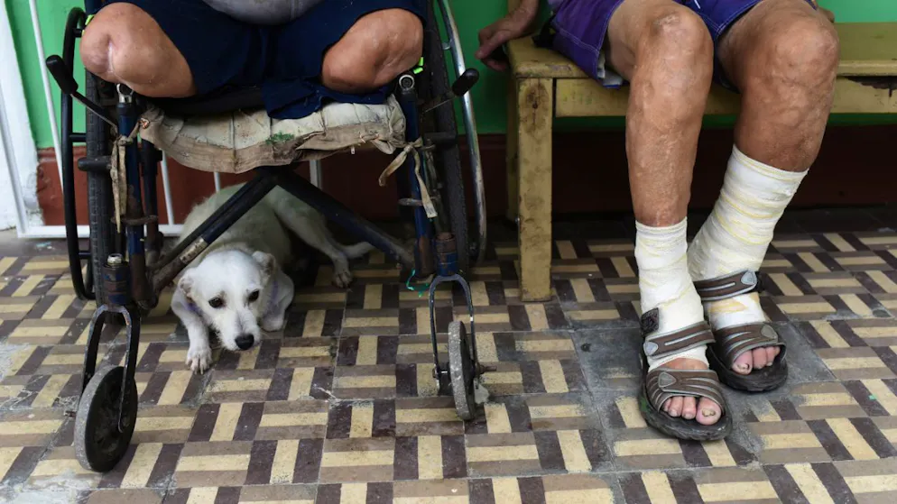 ARCHIV - Leprapatienten sitzen im Gang eines Krankenhauses. Foto: Fabio Teixeira/dpa/Symbolbild