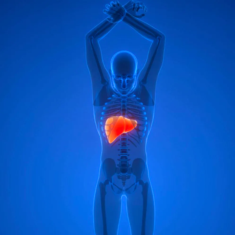 Nuovo studio. Quando il cancro «dirotta» il sistema immunitario: alcune cellule aiutano il tumore