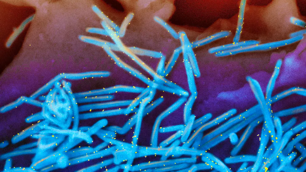 Il virus respiratorio sinciziale (RSV) è un virus a RNA avvolto che al microscopio elettronico presenta una struttura da filiforme a sferica. Provoca infezioni respiratorie in tutto il mondo, soprattutto in inverno, e porta alla fusione delle cellule respiratorie infette.
